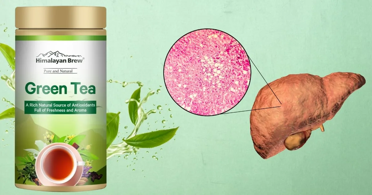 Is Green Tea Good for Fatty Liver, Fatty Liver treatment